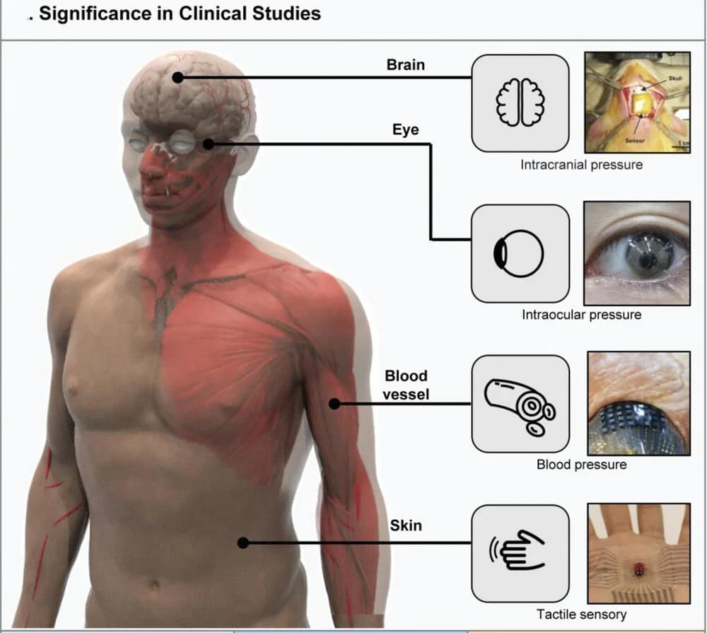 Open access visualization of Illustration, Workflow, Photo, Pressure Sensors, Clinical Applications