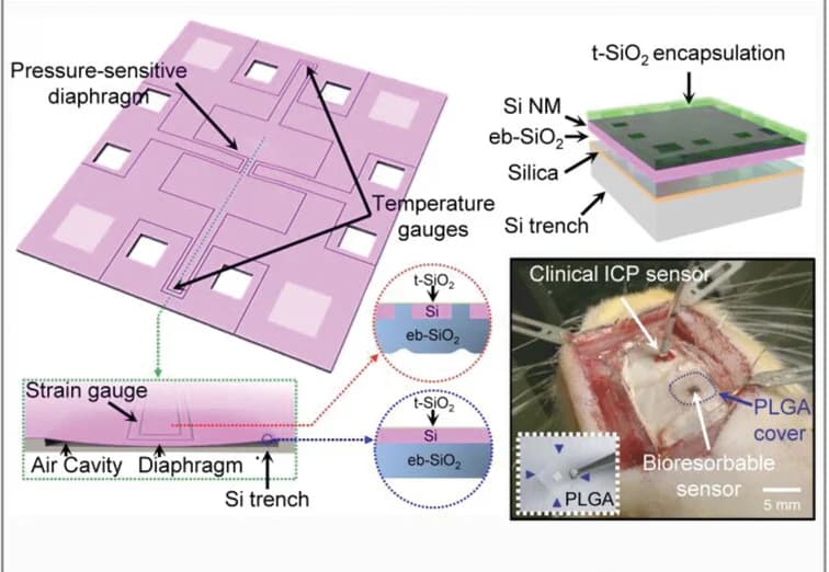 Open access visualization of Illustration, Workflow, Photo, Bioresorbable Pressure Sensor, Recovery Processes
