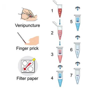 Open access visualization of Workflow, Illustration, Blood Collection, DNA Extraction, RNA Extraction