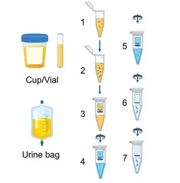 Open access visualization of Workflow, Illustration, Urine, DNA, RNA