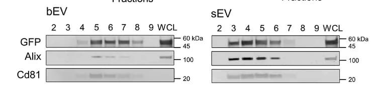 Open access visualization of Gel, Western Blotting, bEVs, sEVs, Proteins