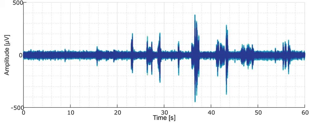Open access visualization of Line Plot, Electrophysiological Recordings, Spontaneous Activity, Cuff Electrode, Leg Movement