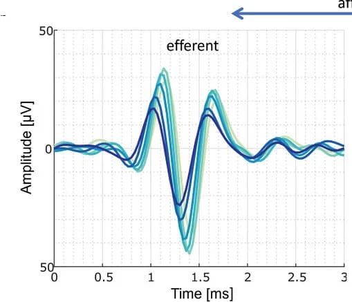 Open access visualization of Line Plot, Electrophysiological Recordings, Motor Signal, Ganglion, Efferent Activity