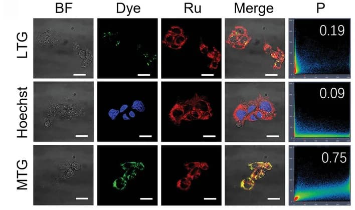Open access visualization of Microscopy, Scatter Plot, Co-localization Confocal Imaging, HepG2 Cells, RuAzNM