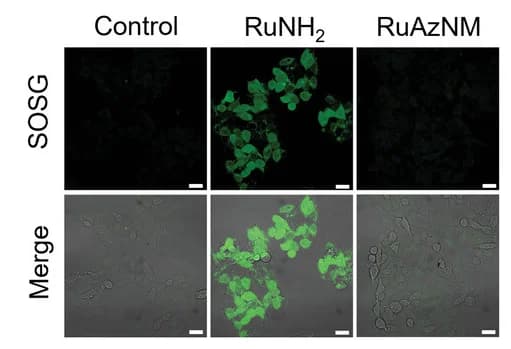 Open access visualization of Microscopy, Singlet Oxygen Generation, HepG2 Cells, Normoxia, SOSG Staining