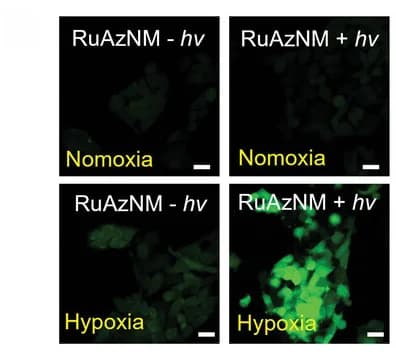 Open access visualization of Microscopy, Intracellular ROS Imaging, HepG2 Cells, Hypoxia, Normoxia