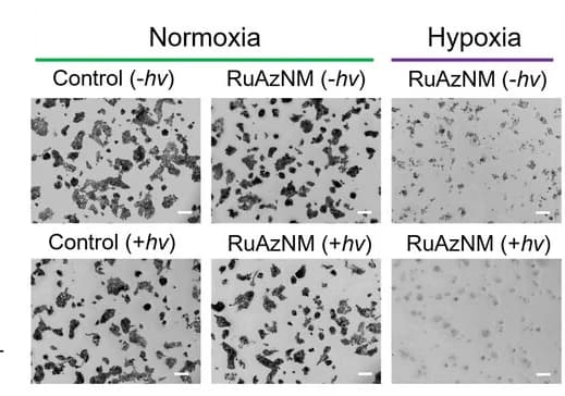 Open access visualization of Microscopy, Formazan Formation Assay, HepG2 Cells