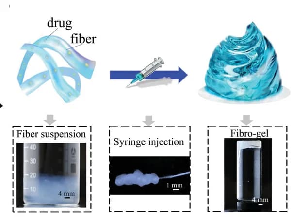 Open access visualization of Workflow, Illustration, Photo, Fibro-gel, Needle