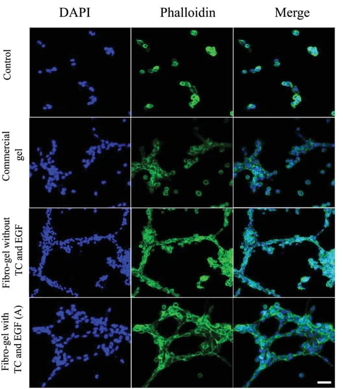 Open access visualization of Microscopy, Vascular Tube Formation, In Vitro, HUVECs, Control Group
