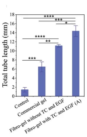 Open access visualization of Bar Plot, Error Bars, Vascular Tube Length, Control Group, Commercial Gel