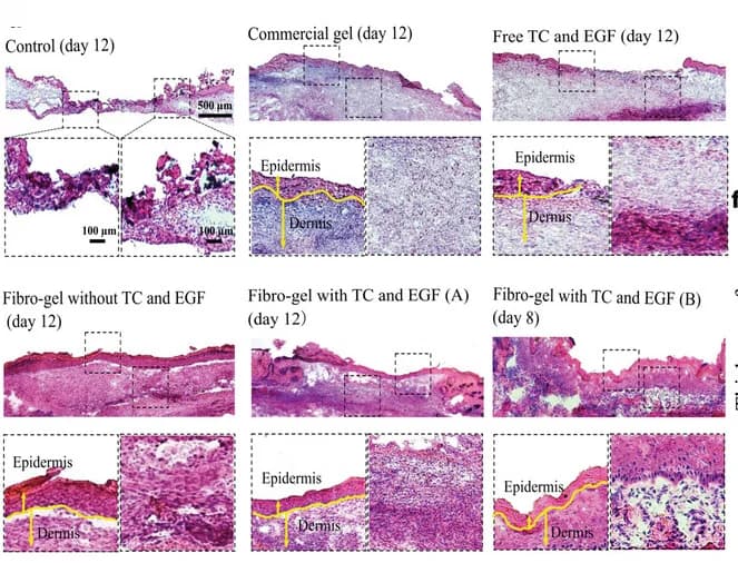Open access visualization of Microscopy, Hematoxylin and eosin staining, Skin tissue, Control group, Commercial gel