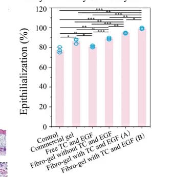 Open access visualization of Bar Plot, Error Bars, Epidermal thickness, Skin tissue, Control group
