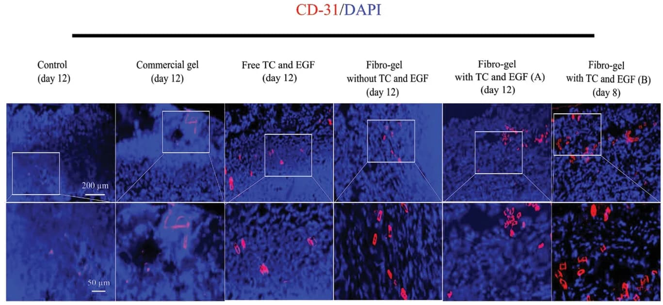 Open access visualization of Microscopy, Immunofluorescence, alpha-SMA, CD31, Wound Tissue