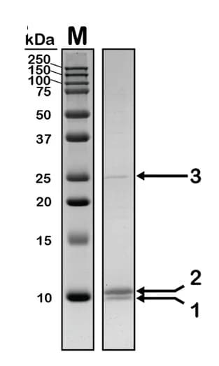 Open access visualization of Gel, SDS-PAGE, Protein, E. coli, Mass Spectrometry