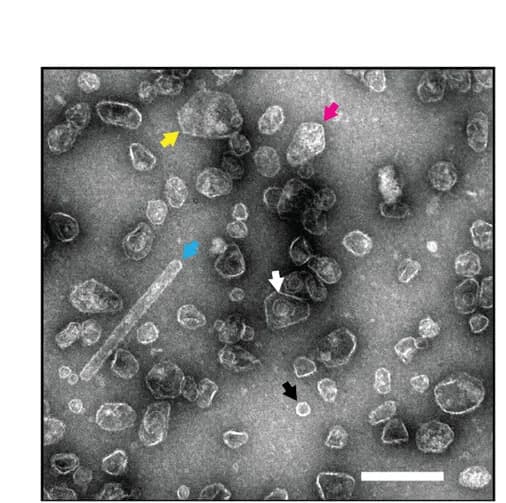 Open access visualization of Microscopy, Negative Stain Electron Microscopy, Shell Morphology, Nanoparticles, GRM3C Shells