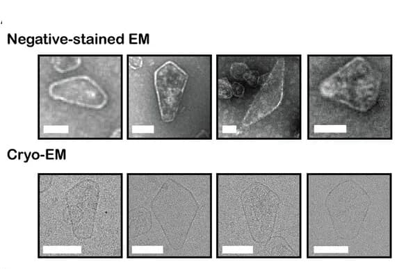 Open access visualization of Microscopy, Nanocones, GRM3C, Negative-Stained EM, Cryo-EM