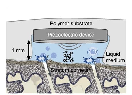 Open access visualization of Illustration, cUSP, Skin, Cavitation Mechanism, Drug Penetration