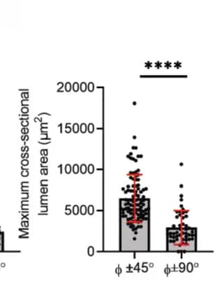 Open access visualization of Bar Plot, Error Bars, Scatter Plot, Lumen, Cross-sectional Area