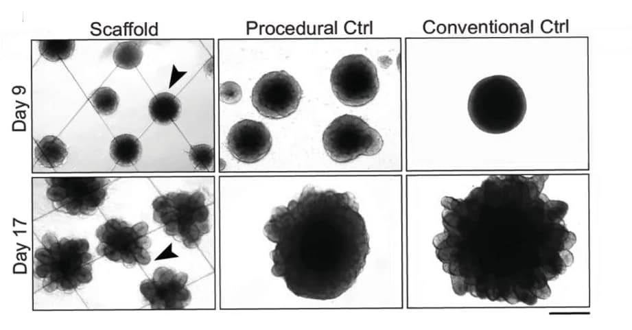 Open access visualization of Microscopy, Bright-field images, Cerebral Organoids, Scaffolds, Procedural Control Organoids