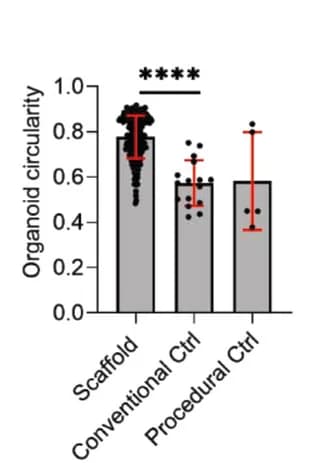 Open access visualization of Bar Plot, Error Bars, Organoids, Circularity, Image analysis