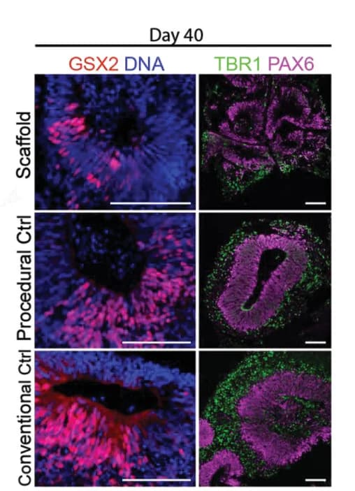 Open access visualization of Microscopy, Histological Sections, Organoids, Ventral Marker GSX2, DAPI