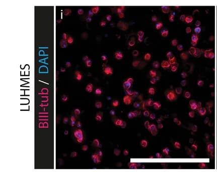 Open access visualization of Microscopy, LUHMES Cells, Cell Density, gelMA µResin, Neuronal Junctions Quantification