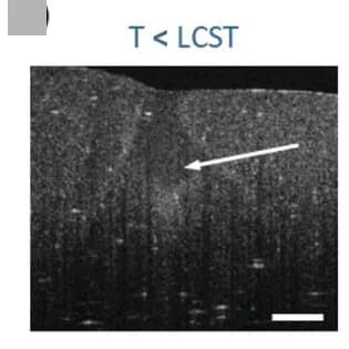 Open access visualization of Microscopy, OCT Image, Brain Phantom, Laser Irradiation, PNIPAM-NGs