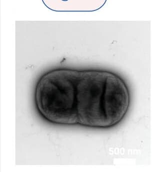 Open access visualization of Microscopy, NS-TEM, A. Baumannii, Protein Nanospears, Attachment