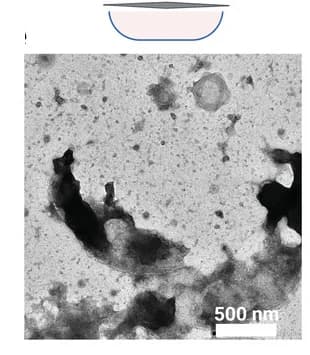 Open access visualization of Microscopy, Cell lysis, Cell Ends