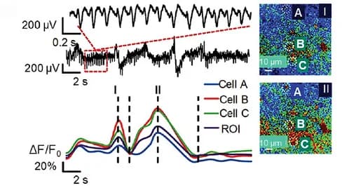 Open access visualization of Line Plot, Microscopy, CNT Electrode Recording, Ca2+ Transients, Two-photon Microscopy