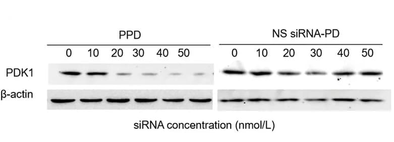 Open access visualization of Gel, 4T1 Cells, siRNA-PD, PDK1 Protein, Western Blot Analysis