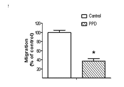 Open access visualization of Bar Plot, Error Bars, PPD-treated 4T1 Cells, Noncoated Transwell Filter, Matrigel-coated Transwell Filter