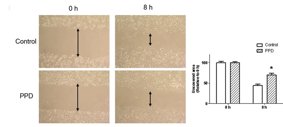 Open access visualization of Bar Plot, Error Bars, Microscopy, 4T1 Cells, Wound Healing Assay