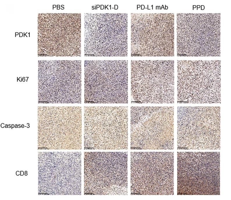 Open access visualization of Microscopy, Immunohistochemistry, Tumors, Cell Proliferation, Ki-67 staining