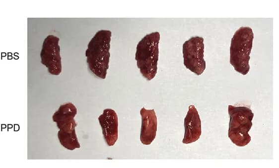 Open access visualization of Photo, Mouse Lungs, PBS Treatment, PPD Treatment, Metastasis