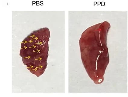 Open access visualization of Photo, Mouse Lungs, PBS Treatment, PPD Treatment, Metastatic Tumors