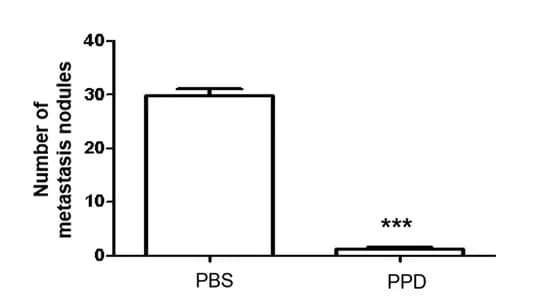 Open access visualization of Bar Plot, Error Bars, Lung Metastasis, Metastasis Nodules, Treatment Groups