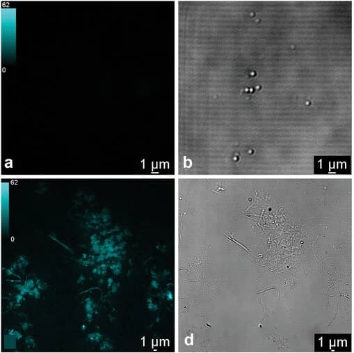 Open access visualization of Microscopy, Ultrasonication, Fluorescence