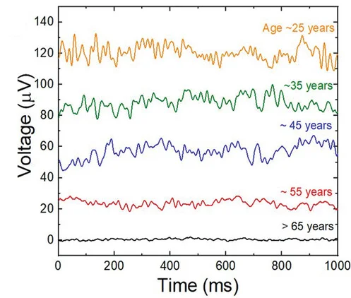 Open access visualization of Line Plot, EEG Dataset, Age Groups