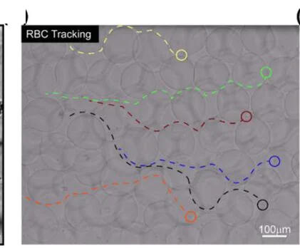 Open access visualization of Microscopy, Microscopic Image, Particle Tracking, RBCs, Perfusion