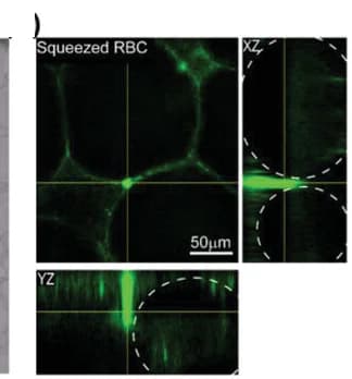 Open access visualization of Microscopy, Fluorescent Confocal Microscopy, DiOC6, RBC, Capillary Space