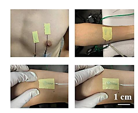 Open access visualization of Photo, Optical Images, ECG, EMG, Patch