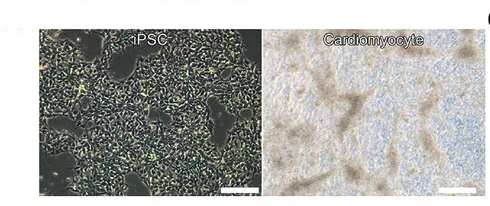 Open access visualization of Microscopy, Brightfield Image, Induced Pluripotent Stem Cells, Cardiomyocytes