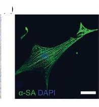 Open access visualization of Microscopy, Fluorescent Image, Sarcomeric Actin, Myocardial Structure