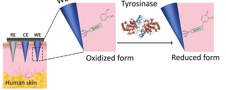 Open access visualization of Workflow, Illustration, Smart Probe, Microneedles, Tyr Enzyme