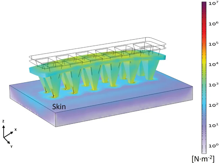 Open access visualization of 3D Plot, von Mises Stress, Microneedle, Human Skin, PU:PEDOT:PSS Composite