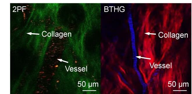 Open access visualization of Microscopy, 2PF, BTHG Imaging, Mouse Ear, OTBP NCs