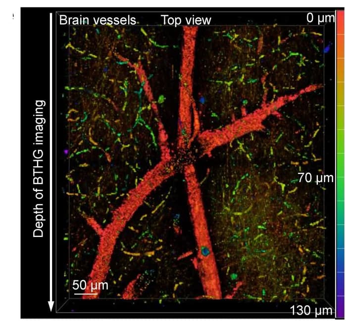 Open access visualization of Microscopy, BTHG Imaging, Brain Vessels