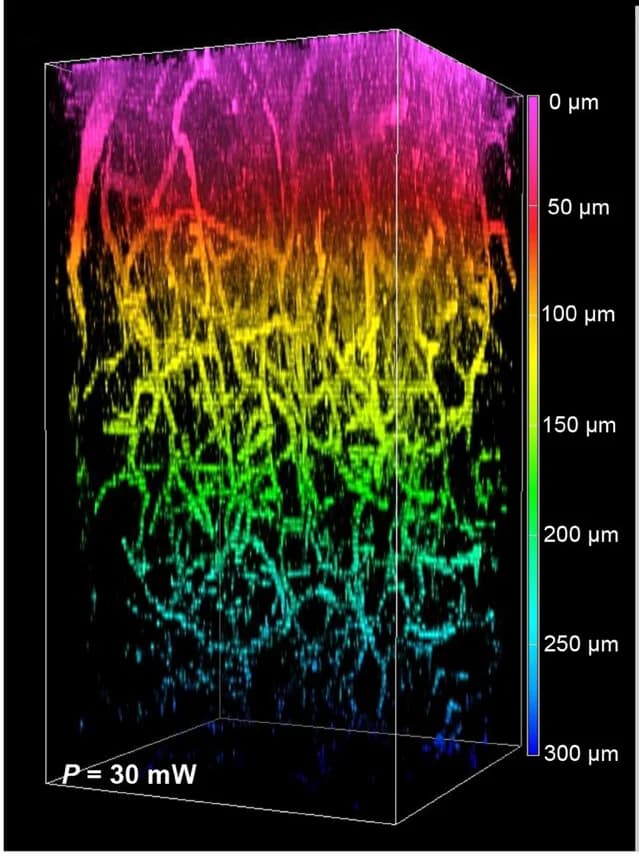 Open access visualization of 3D Plot, 3D Reconstructions, Brain Vessels, Laser Power, BTHG Images