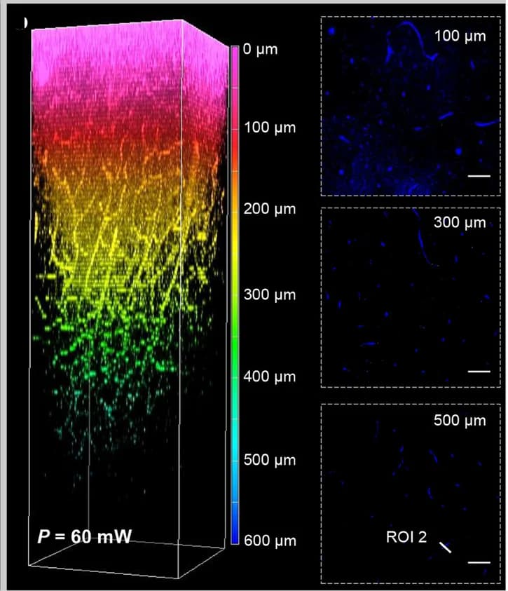 Open access visualization of Microscopy, 3D Reconstructions, Brain Vessels, Laser Power, BTHG Images